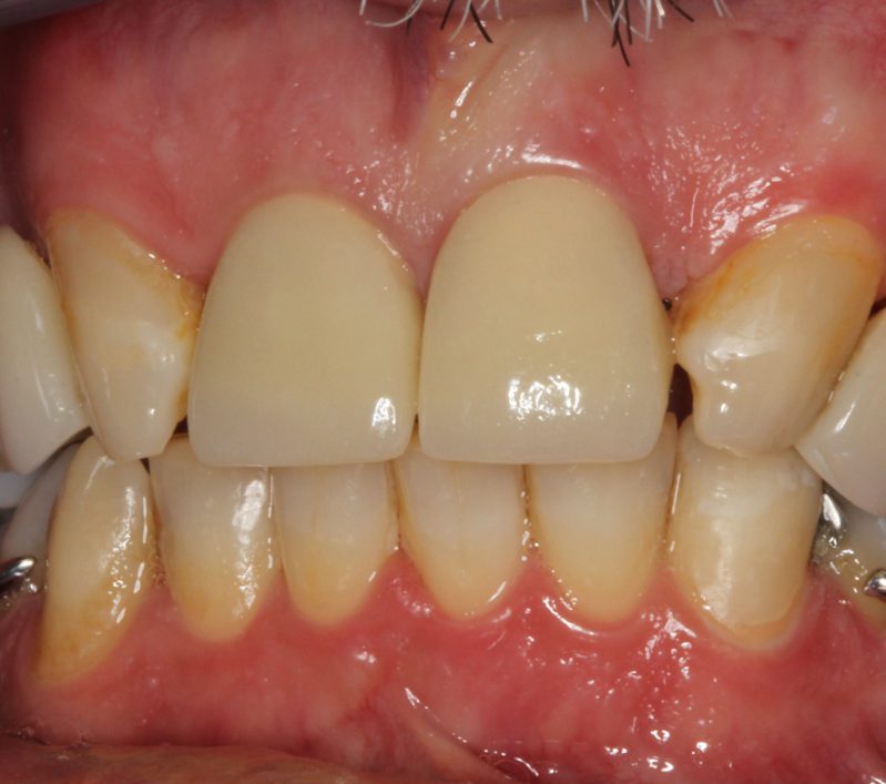 smile gallery photo