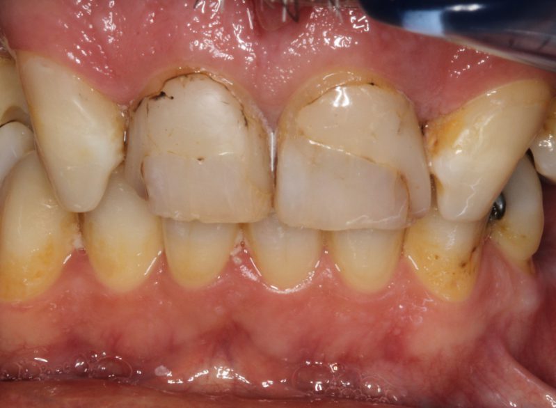 smile gallery photo
