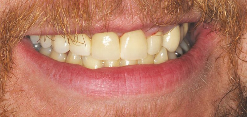 smile gallery photo