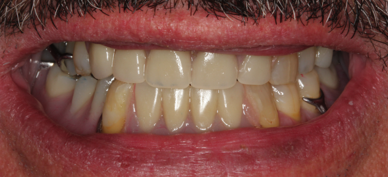 smile gallery photo