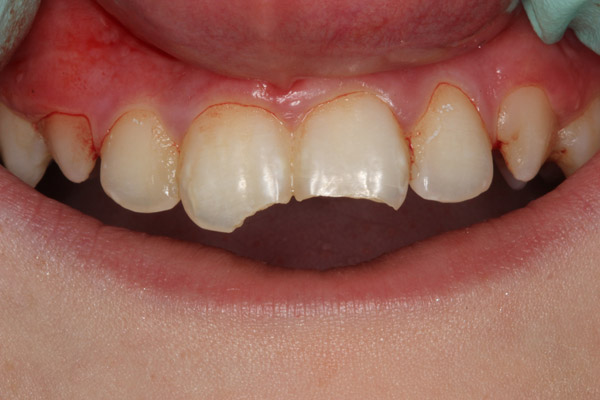 smile gallery photo