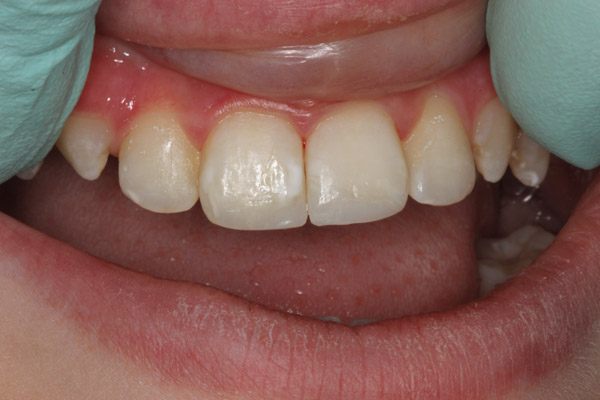 smile gallery photo