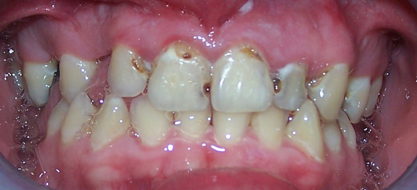 smile gallery photo