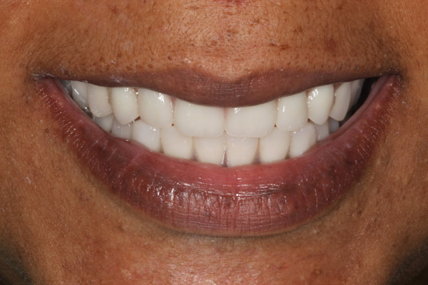 smile gallery photo