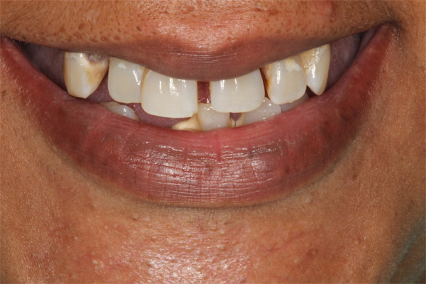 smile gallery photo