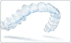 clear aligner