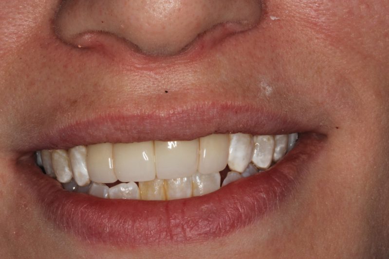 smile gallery photo