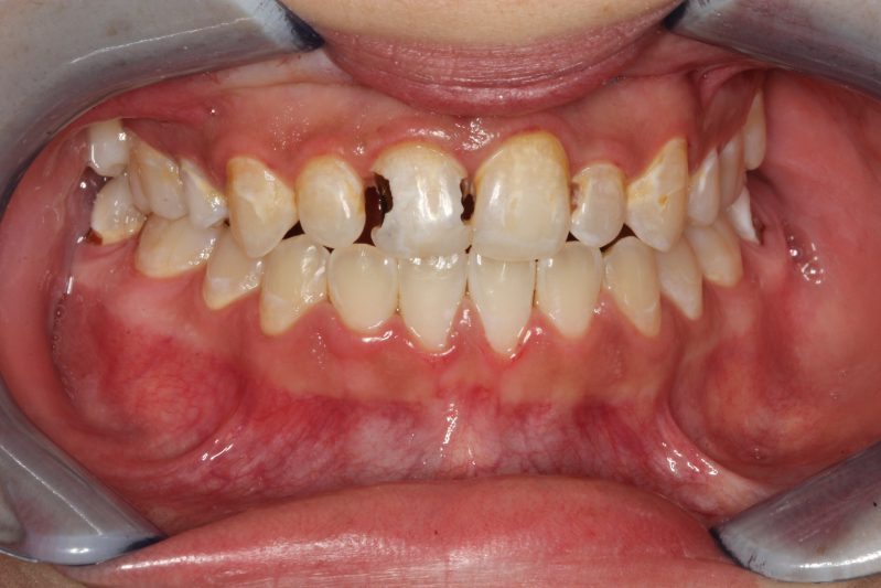 smile gallery photo