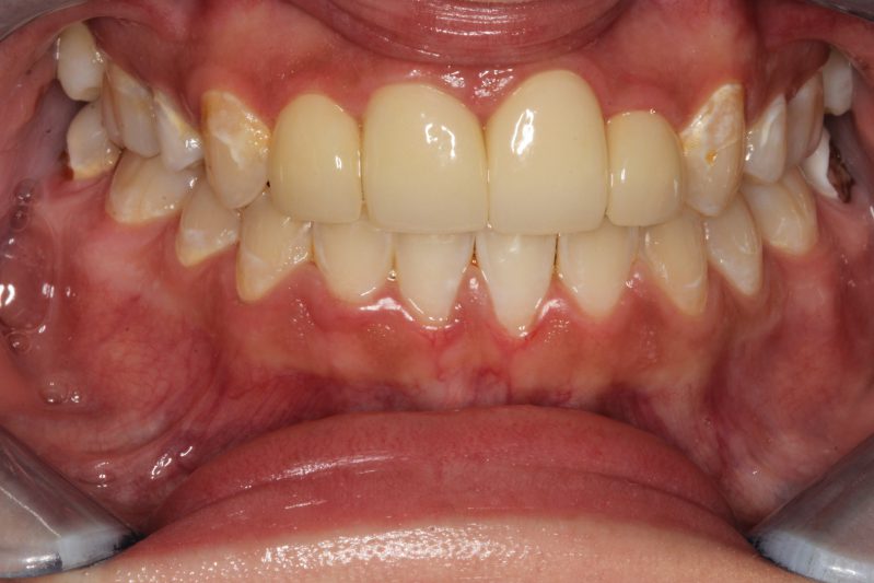 smile gallery photo
