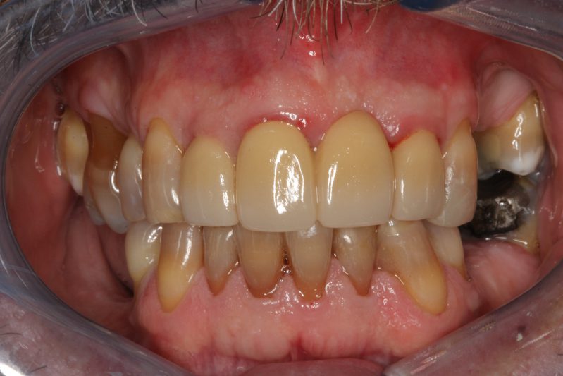smile gallery photo
