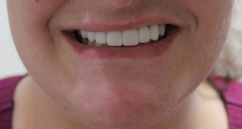 smile gallery photo