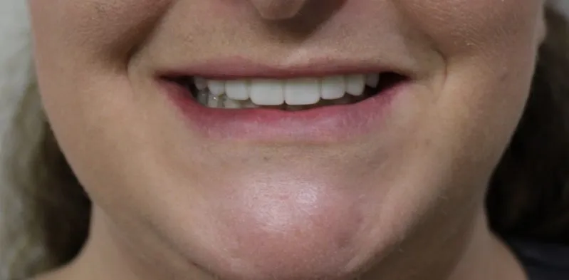 smile gallery photo