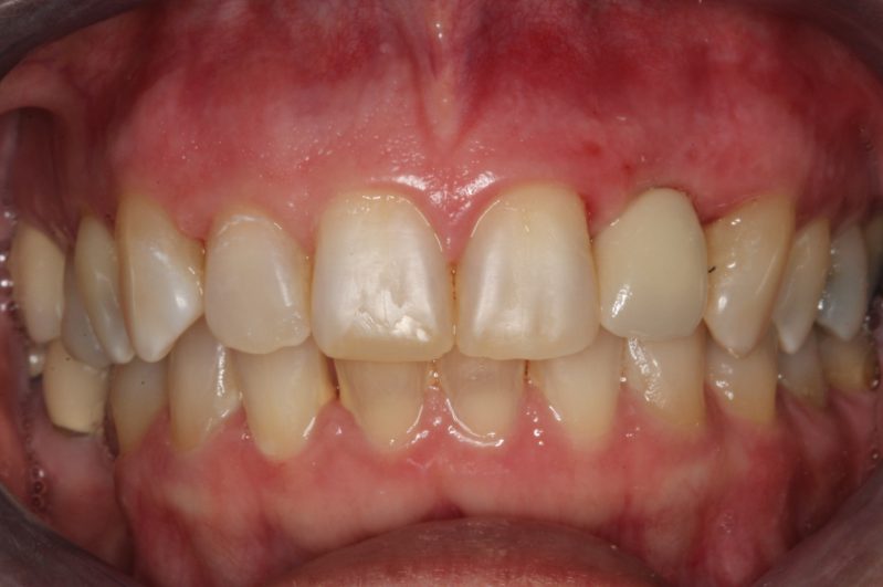 smile gallery photo