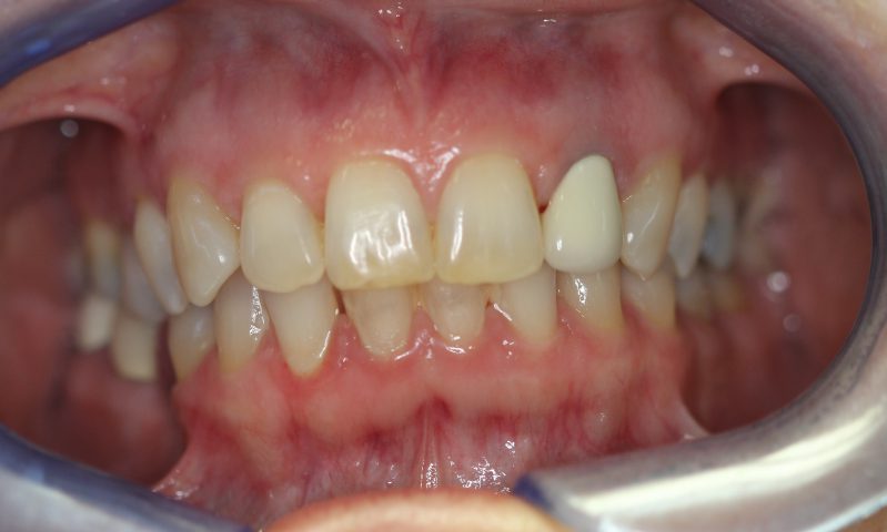 smile gallery photo