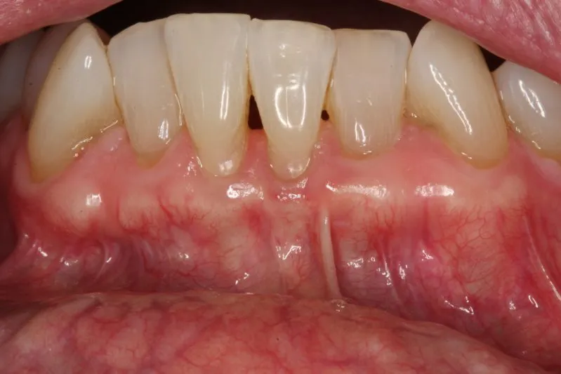 smile gallery photo