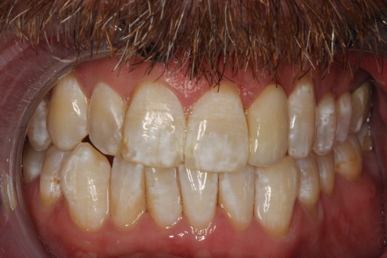 smile gallery photo