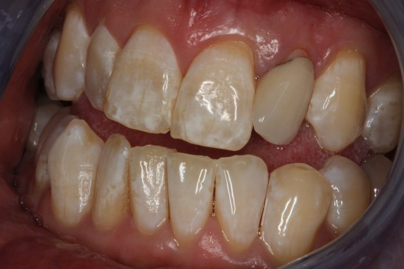 smile gallery photo