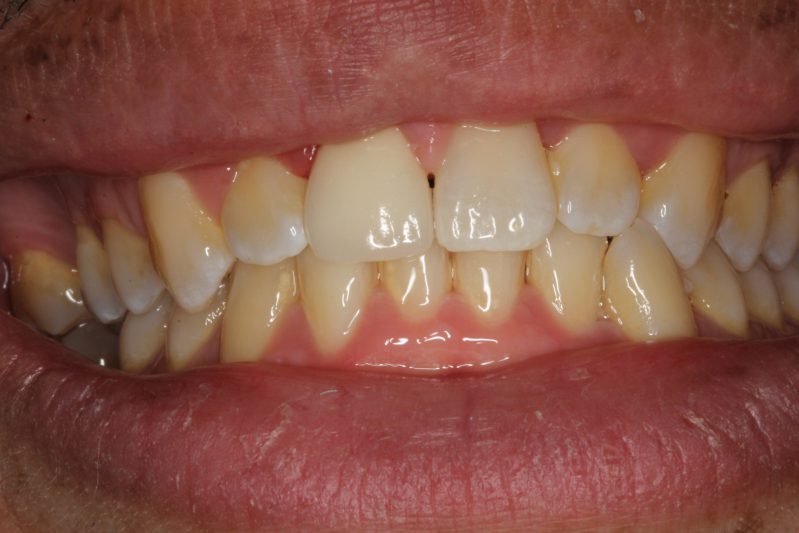 smile gallery photo
