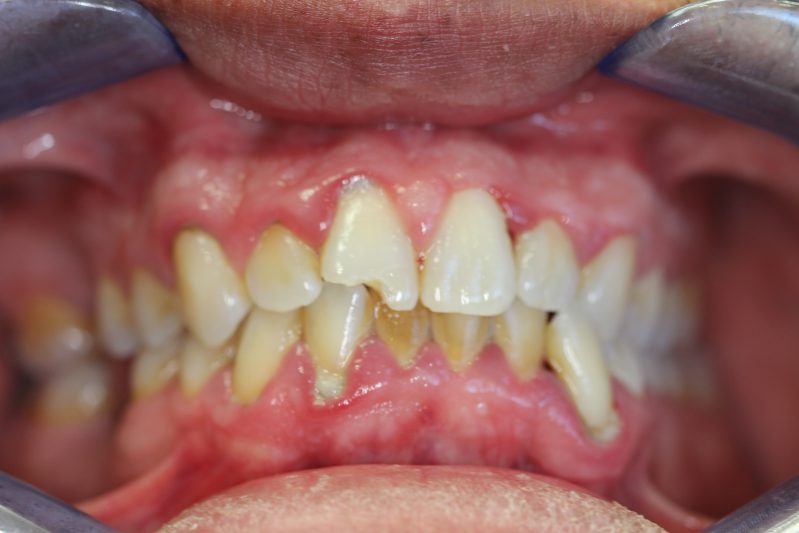 smile gallery photo