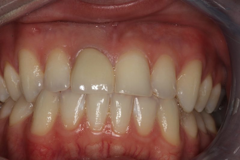 smile gallery photo