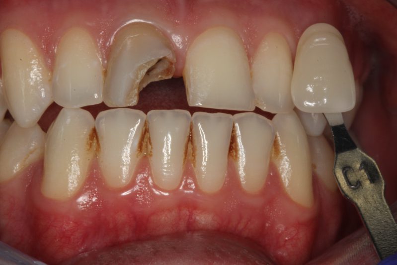 smile gallery photo