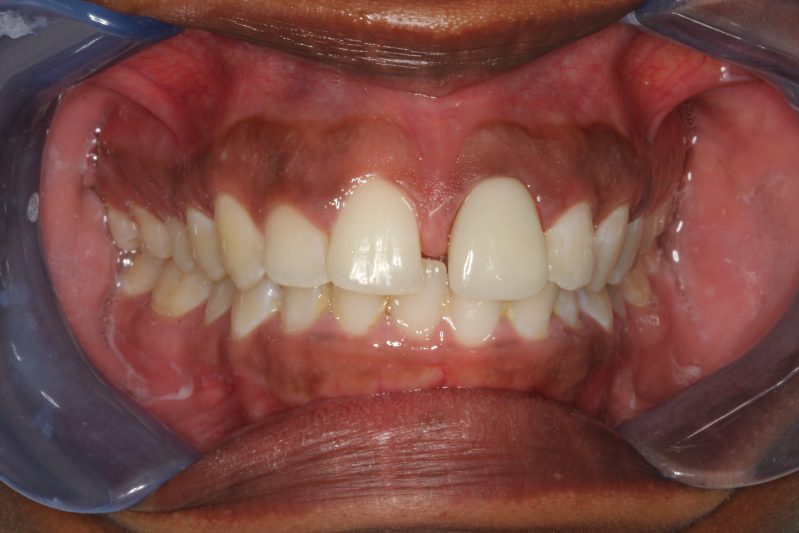 smile gallery photo
