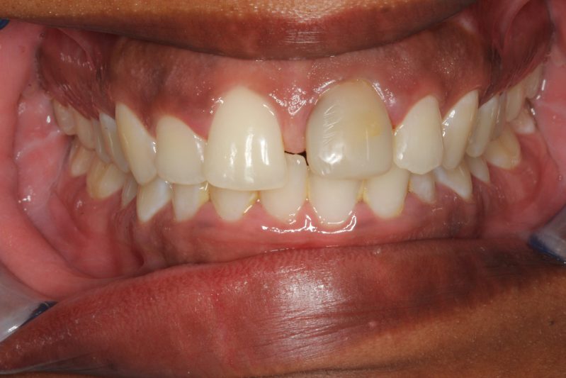 smile gallery photo