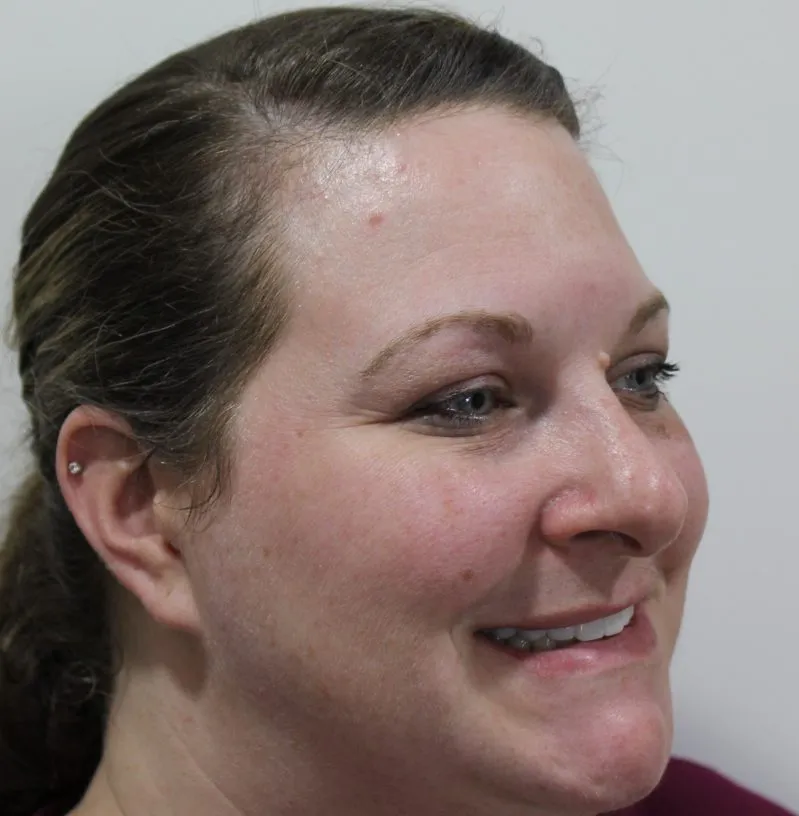 smile gallery photo