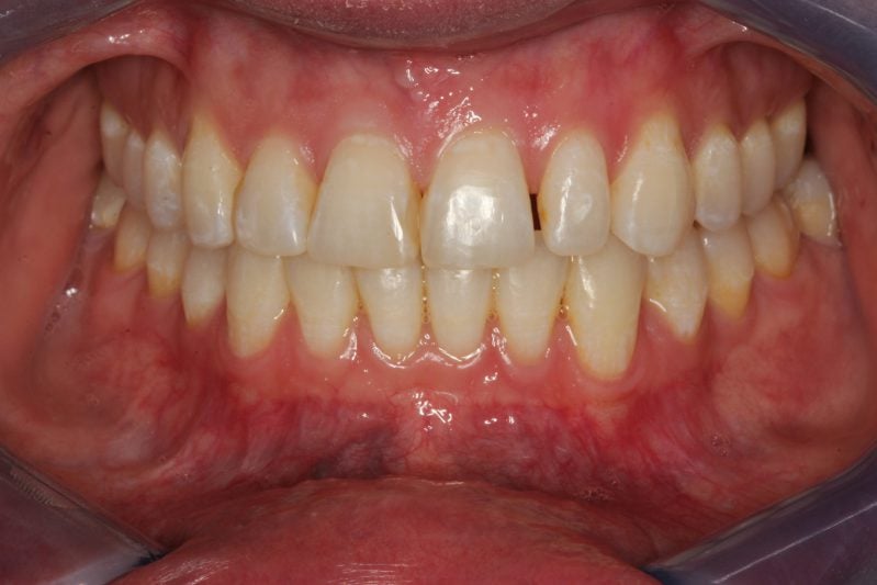 smile gallery photo