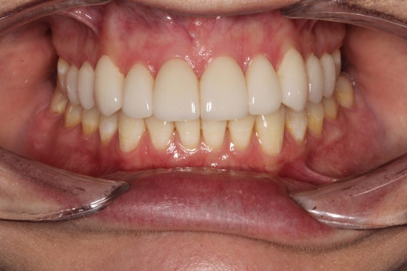smile gallery photo