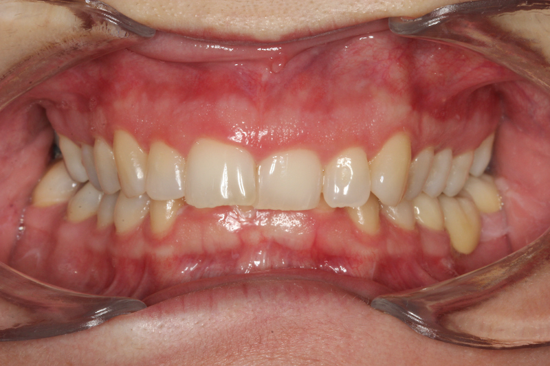 Before Image