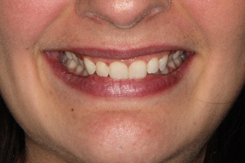 Before Image