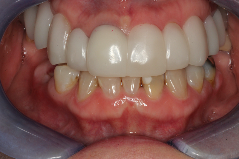 After Image