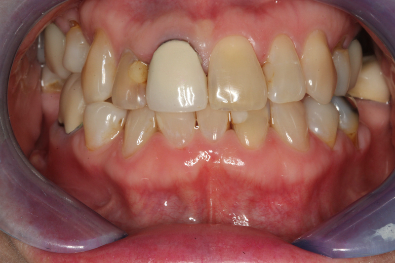 Before Image