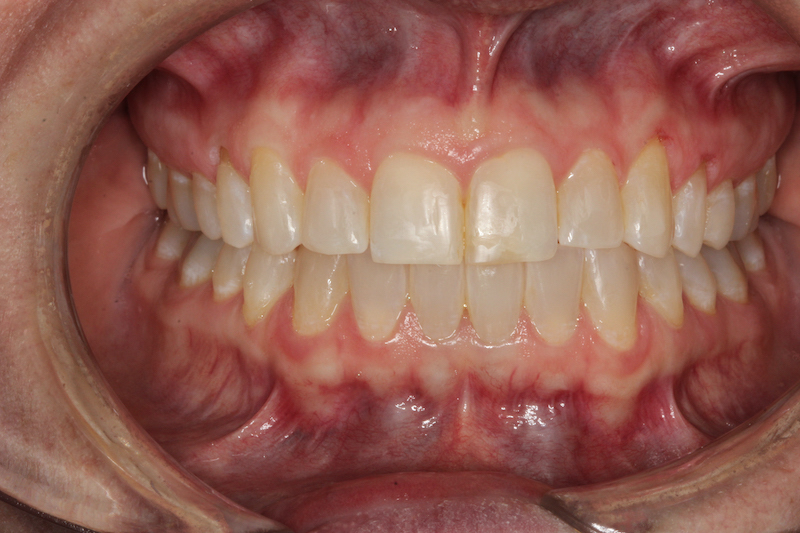 After Image
