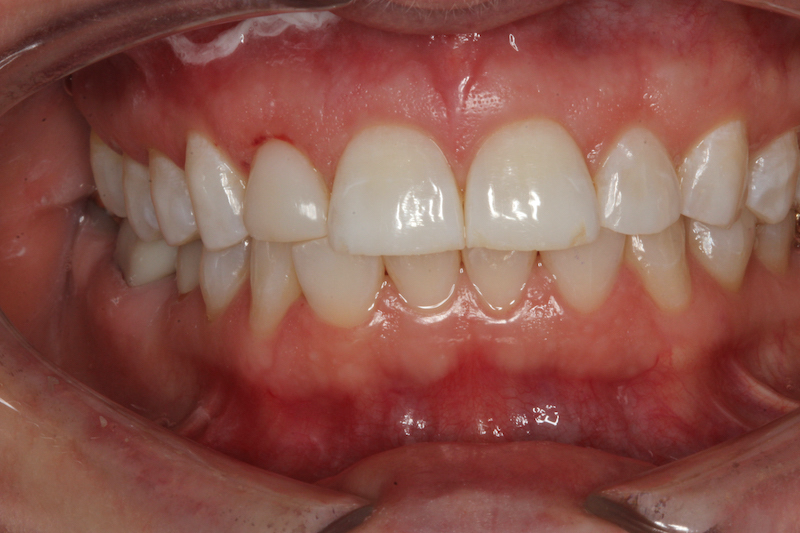 After Image