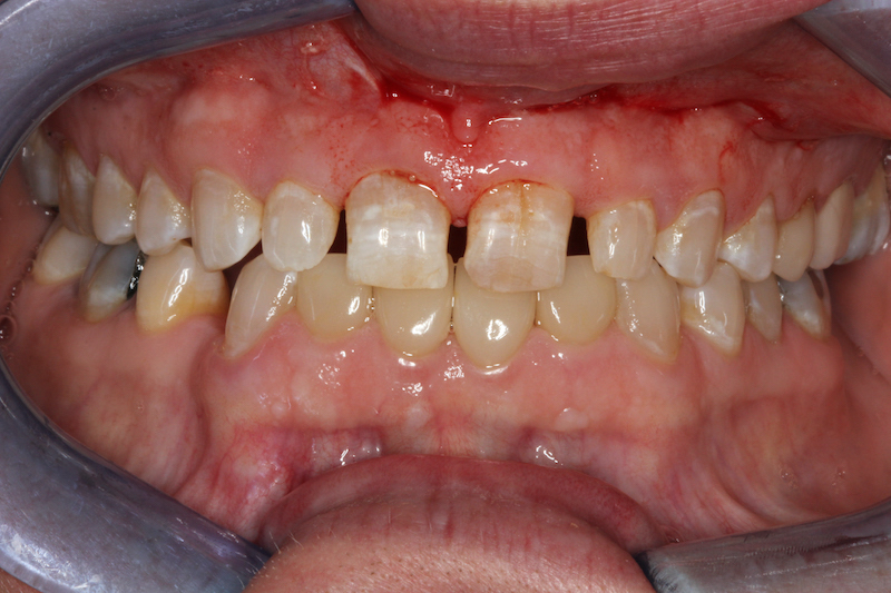 Before Image