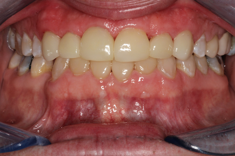 Before Image