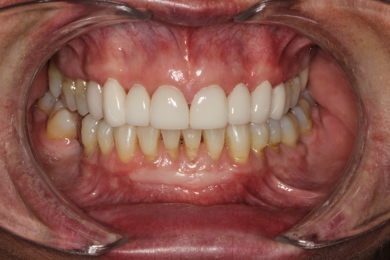 After Image