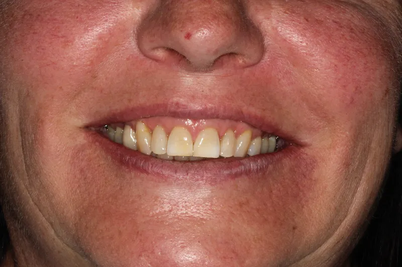 Before Image