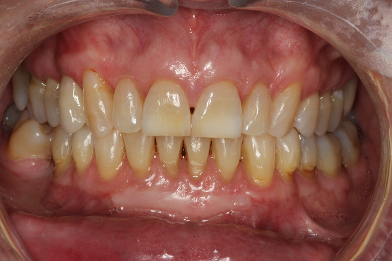 Before Image