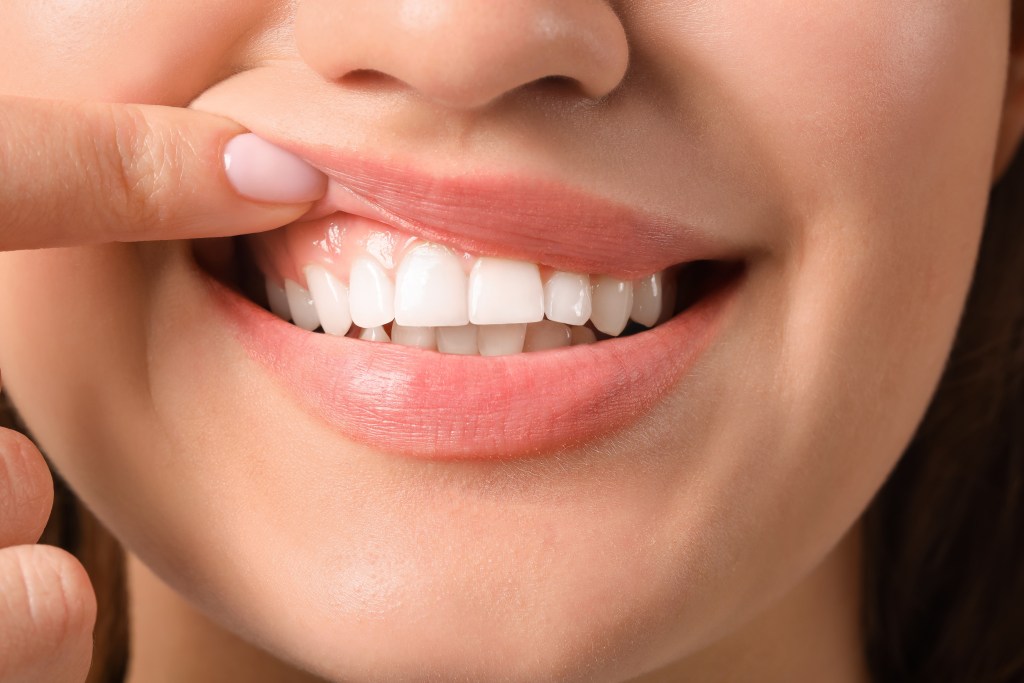  scaling and root planing gum disease